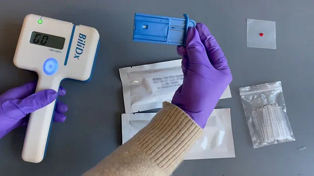 A Point of Care Bilirubinometer Using Blood: BiliDx