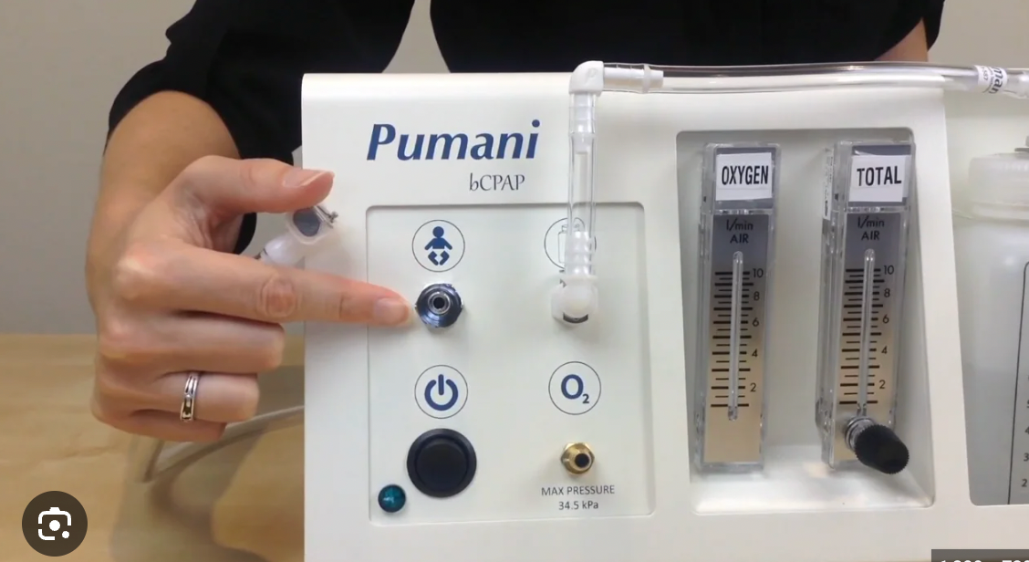 Pumani bubble CPAP for respiratory distress syndrome in children 1 to 59 months; SDG3; innovation