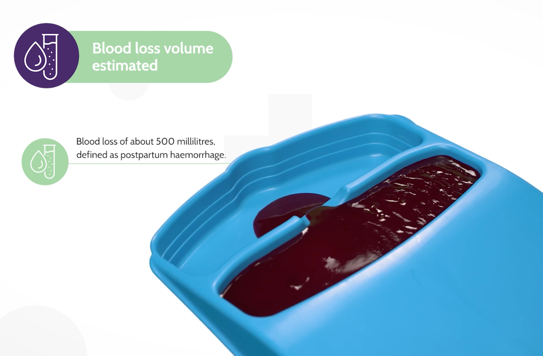 E-MOTIVE follow up estimation of postpartum blood loss with a tray called the MaternaWell