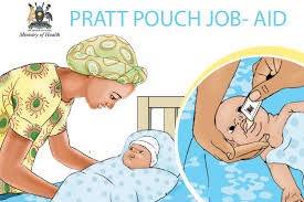 Pratt Pouch and PMTCT with ARVs