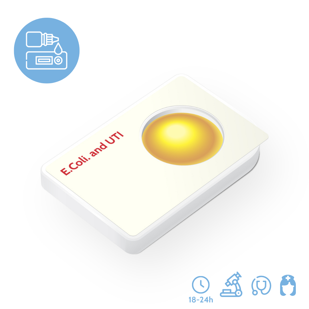 UTI rapid test for e coli and culturing